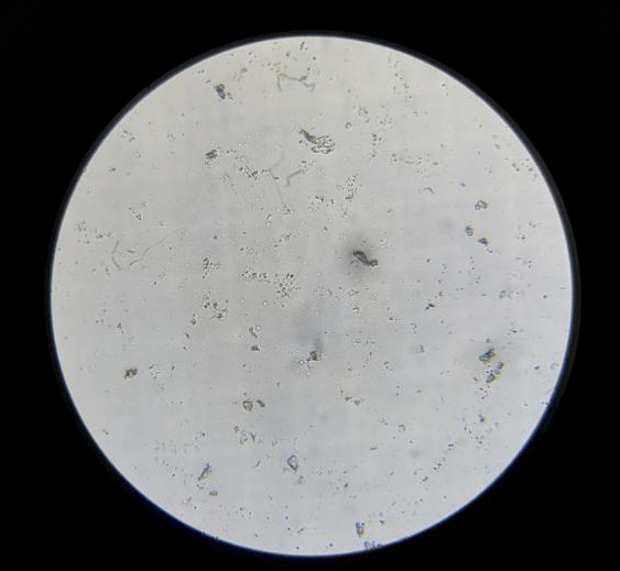 (同学在使用显微镜观察血球计数板中的细菌)取样之后,使用直接显微