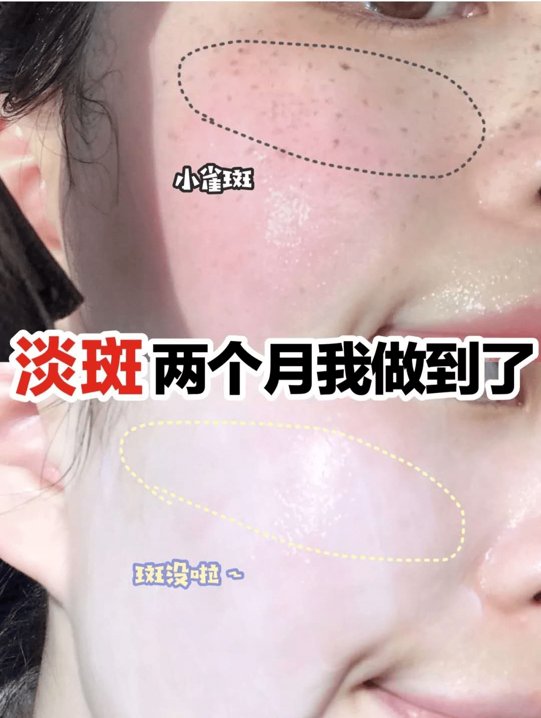 9b280d24852d46289b2ea905774f11a1.png