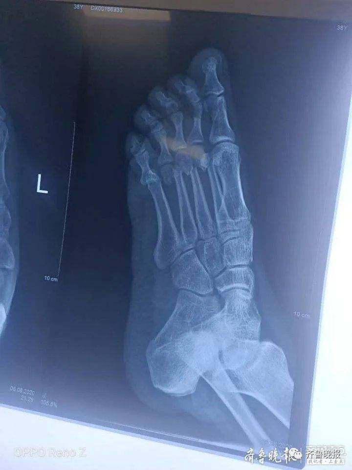 孩子|山东一水电维修员16楼跳至15楼窗外救起3岁娃，脚部骨折