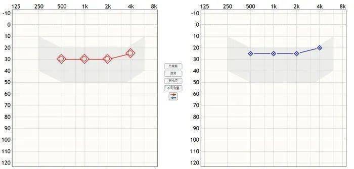 的测试结果均在言语香蕉图内,表明这个助听器对于橙橙的助听效果很好