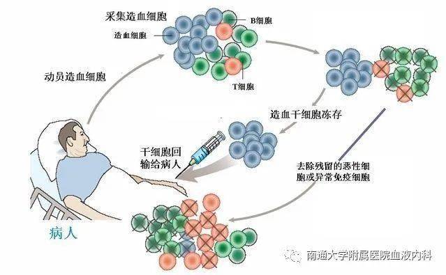 造血干细胞捐献,会对身体有伤害吗?