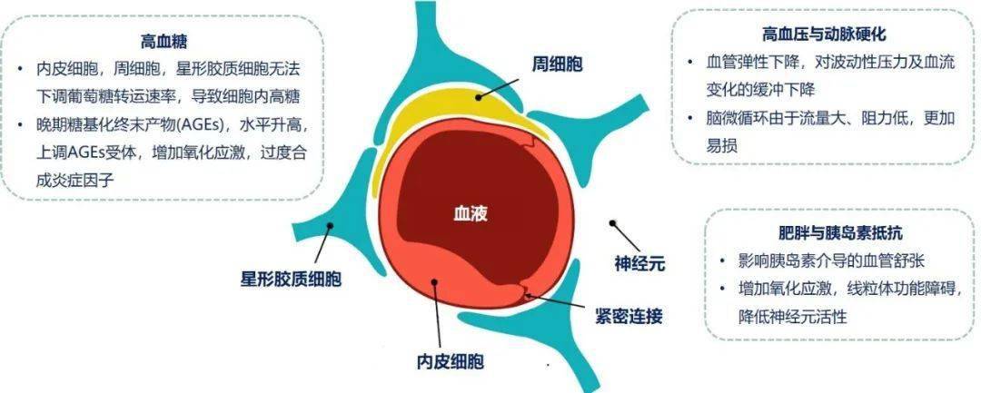 糖尿病学术前沿2型糖尿病的脑微循环并发症