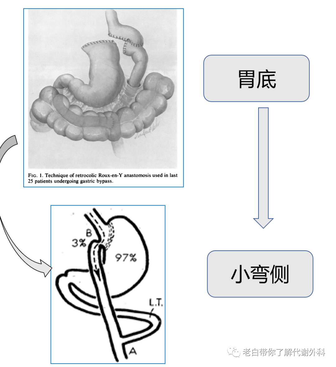 一图读懂——胃食管反流病__中国医疗