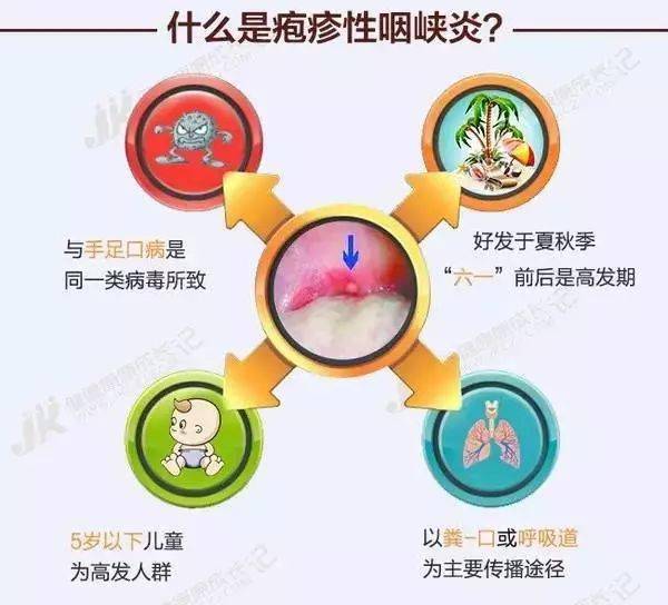孩子|幼儿疱疹性咽峡炎进入高发期！家里有孩子的一定要注意！