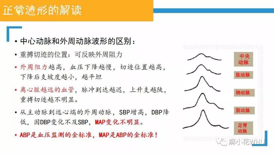 如何做好有创动脉血压监测及其波形分析?史上最详细的解读来了!