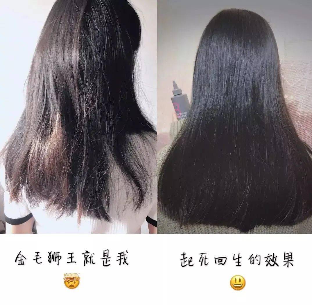 李佳琦推荐的脱发克星!一次就能拯救头屑头痒头油,用了它头发都会跳舞!