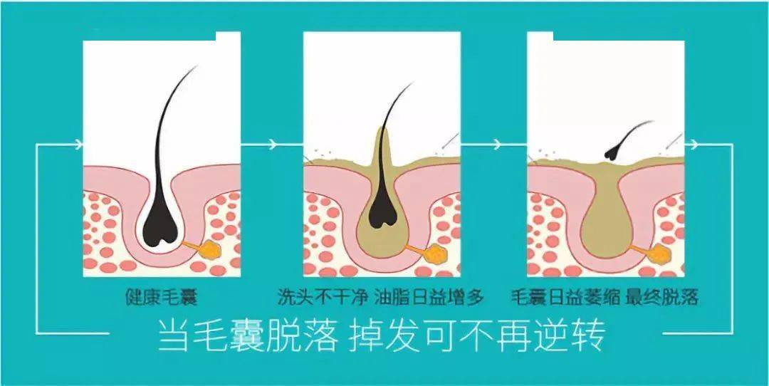 李佳琦推荐的脱发克星!一次就能拯救头屑头痒头油,用了它头发都会跳舞!