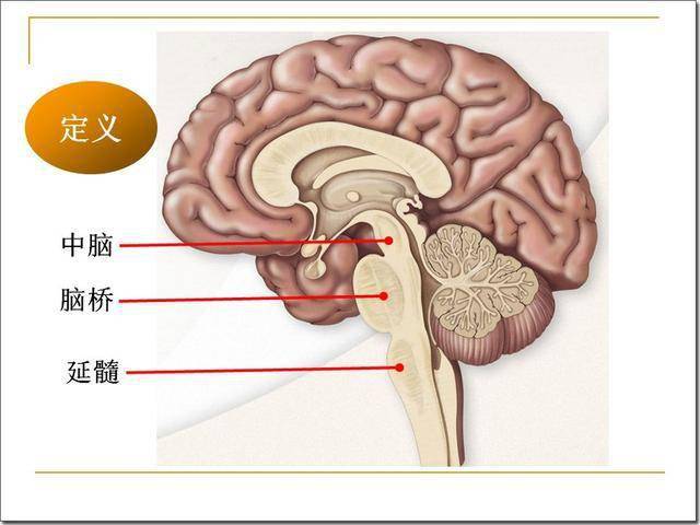 脑干解剖及损害分析