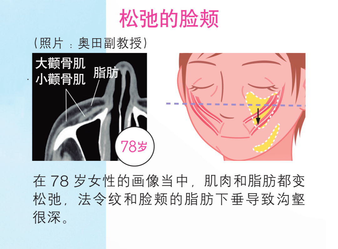 d59f9568befa4793b6de3fbe60117eae.png