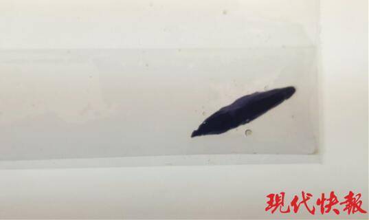 孩子|十个月大男婴肠壁被刺破枣核险成“夺命暗器”