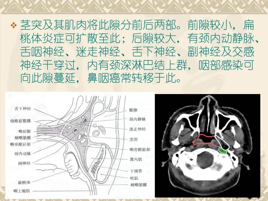 咽部CT解剖结构图解,喉部ct解剖图(5) - 伤感说说吧