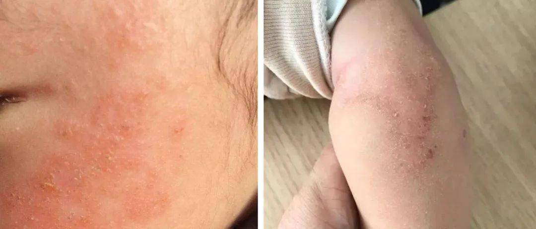 Hipapa|洗澡、洗头、净水三合一的免冲洗儿童沐浴露