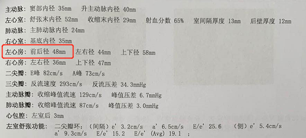 超声心动图上的