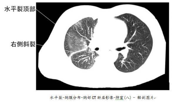 全身ct图谱 // 美国naha芳疗师认证考试