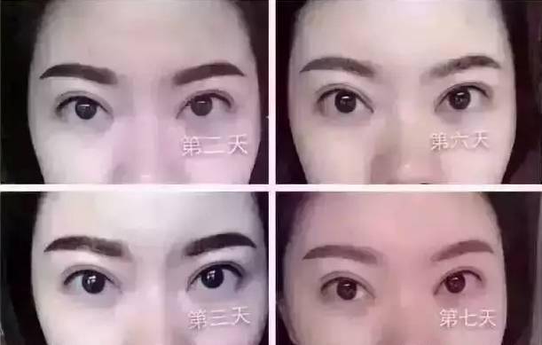 刚做完眉毛,眉色深一点,粗一点很正常