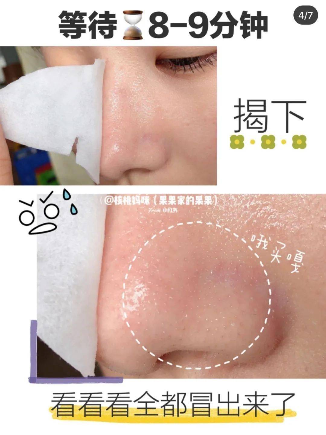 毛孔|原来想要拥有干净、清透的“初恋素颜脸”，只需要做好这一步！