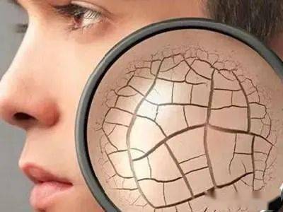 患者|夏天脱水怎么处理？