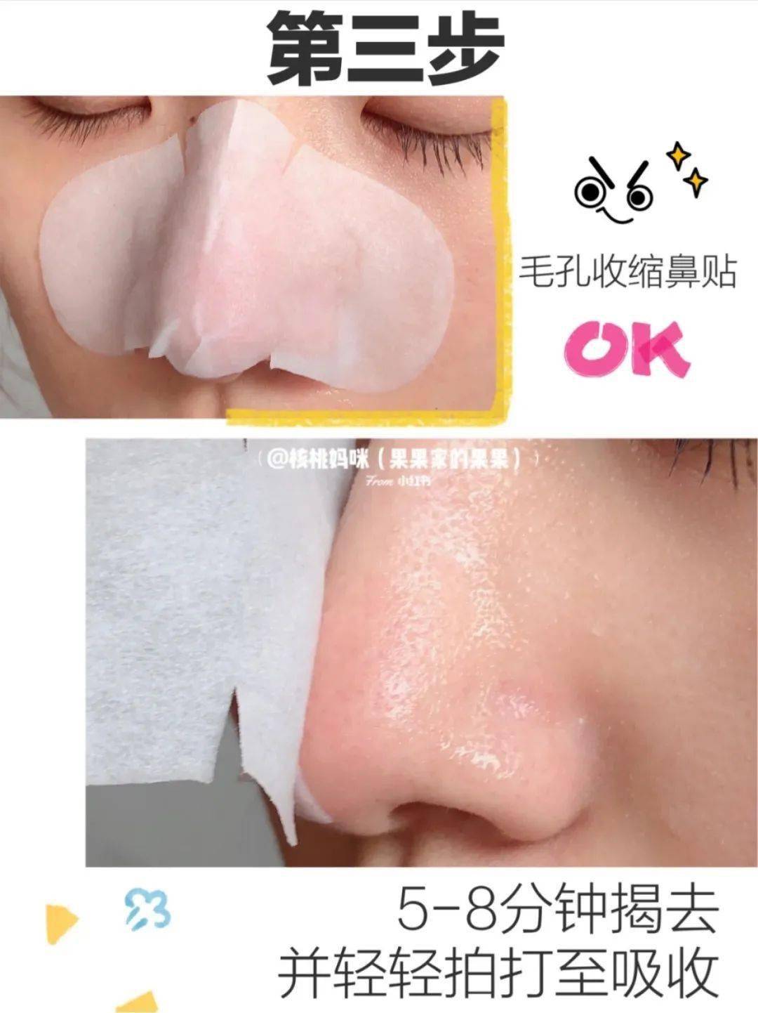 毛孔|原来想要拥有干净、清透的“初恋素颜脸”，只需要做好这一步！