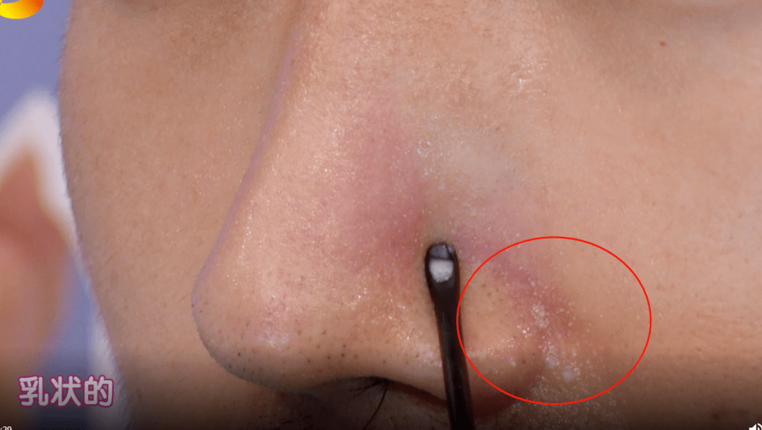 毛孔|原来想要拥有干净、清透的“初恋素颜脸”，只需要做好这一步！