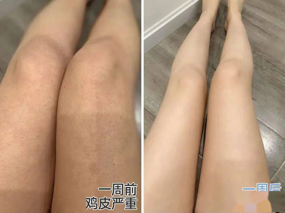 全身|洗澡时多搓搓这2处，疏通全身，更显年轻，体味淡多了