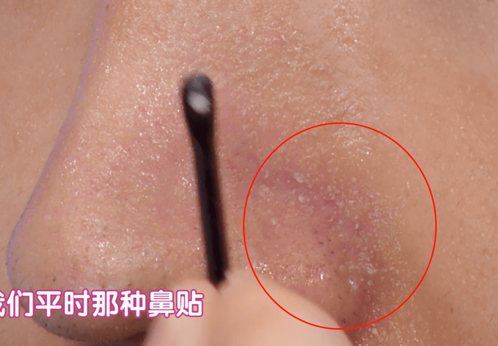 毛孔|原来想要拥有干净、清透的“初恋素颜脸”，只需要做好这一步！