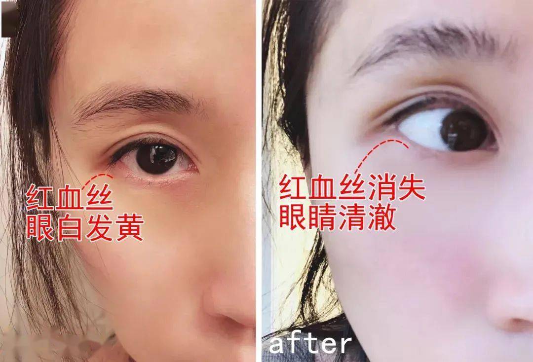 眼罩|明亮双眸!新一代冰感眼罩,冰热双温SPA,赶走黑眼圈、红血丝!