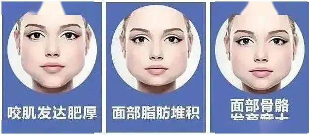 如何减肥不瘦脸呢 ae941ca68ef94b7588092964f55604dd.jpeg