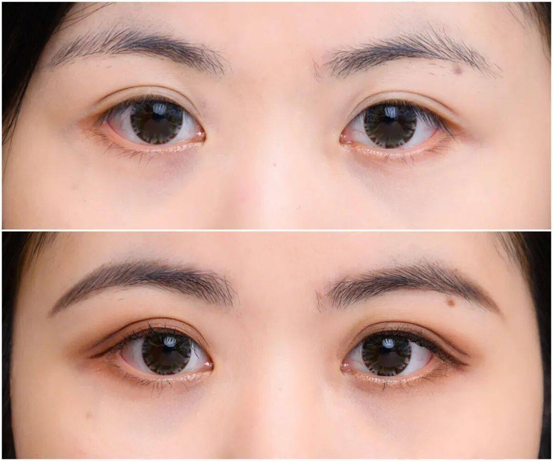 眼睛|张雨绮为啥越看越可爱，这一点真的很重要