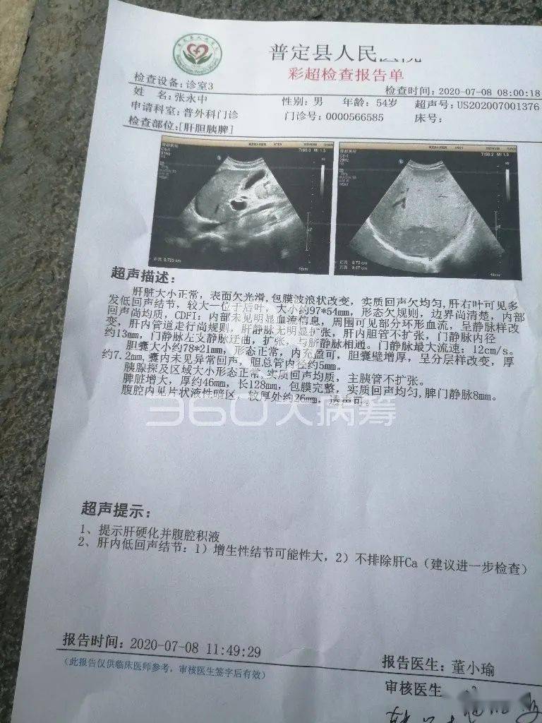 求助:鸡场坡张永忠身患肝癌,恳请好心人救救他!
