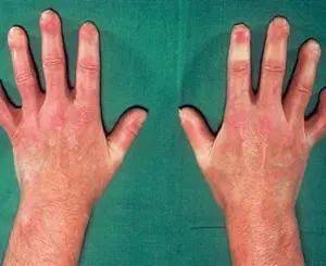 弥足珍贵|你讨厌的皱纹,对他们来说却弥足珍贵