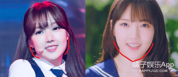 五官|整坏了?这是要找医生赔偿的程度…