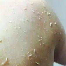 角质|能搓出“脏东西”的它3秒卖出一瓶！去角质、黑头、收毛孔，给你肌肤来次“大扫除”!