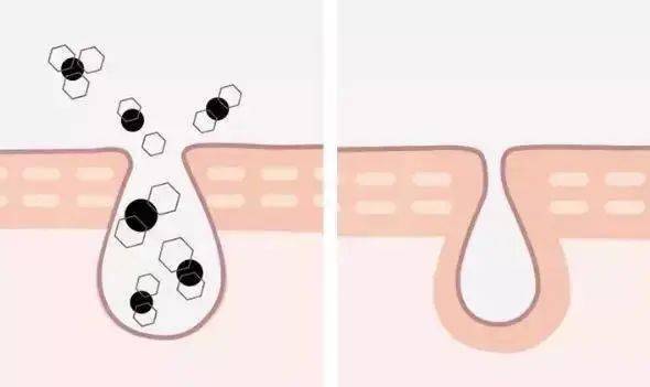 角质|能搓出“脏东西”的它3秒卖出一瓶！去角质、黑头、收毛孔，给你肌肤来次“大扫除”!