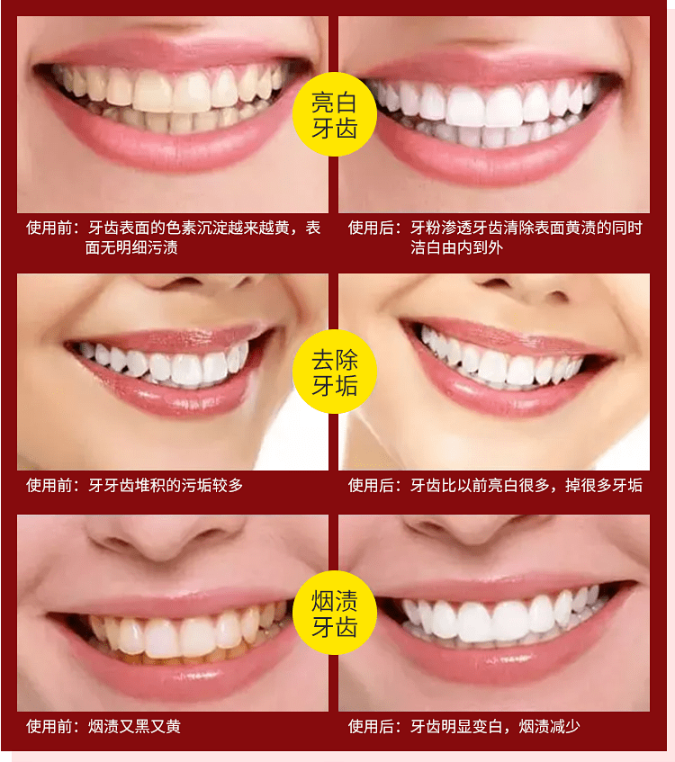 老人口发黑_人口普查(3)