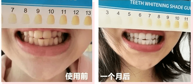 牙粉|爱笑的女人真美