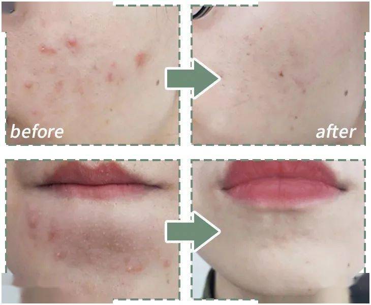 肚脐|想穿什么就穿什么的自信丨好物