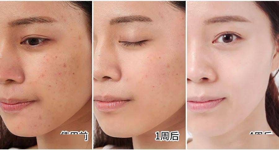 鲜肉|“少女脸”奶奶惊艳全球,61岁又泡到28岁鲜肉,网友:好狠,这女的!