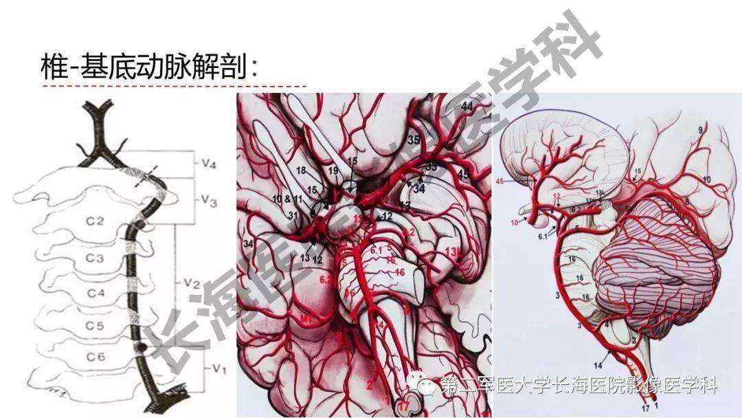 精彩推荐 | 脑供血动脉常见变异