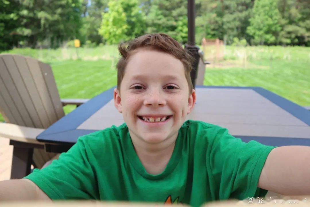 刘宇宁|原来天生的帅哥脸也会被祖传的法令纹困扰着