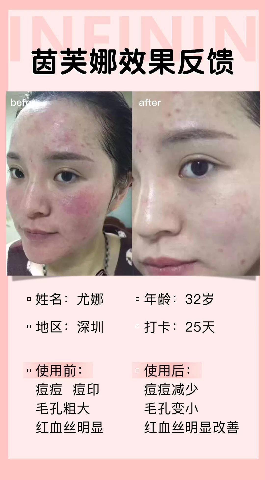 面膜|官宣？！《乘风破浪的姐姐》保养C位出圈的绝对是她...