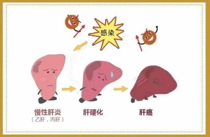 "世界肝炎日" 7月28日是是第十个"世界肝炎日",此次宣传主题是:"主动