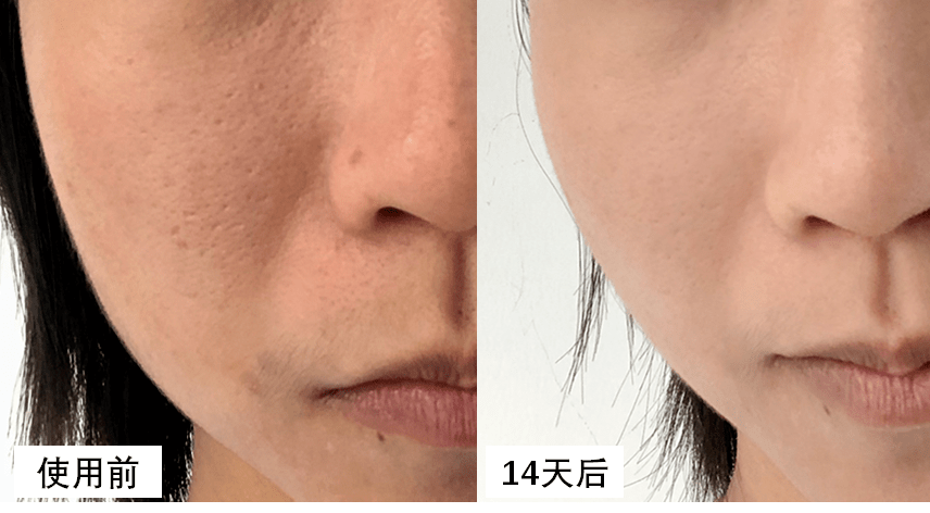 肌肤|50岁钟丽缇干了啥？！迷倒小12岁奶狗，不老神术教教我…