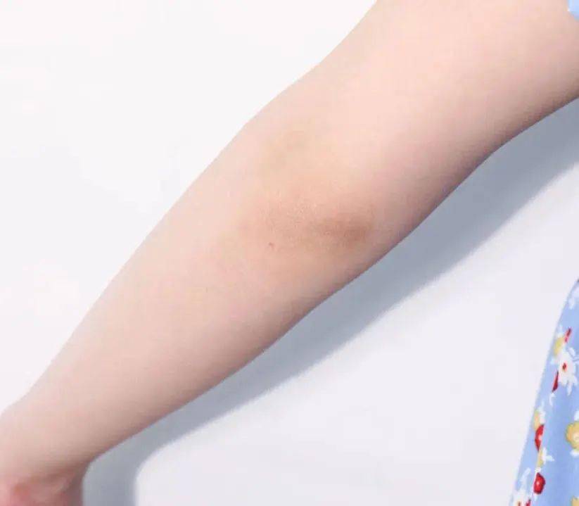 肤色|脖子比脸黑太多？夏日的宝藏救星，没想到竟是它！