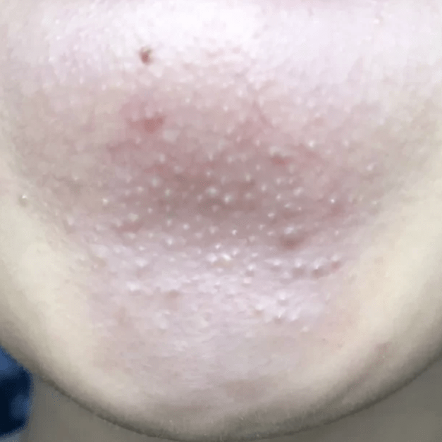 皮肤|纯分享：我最爱的11款小众面膜都在这了！