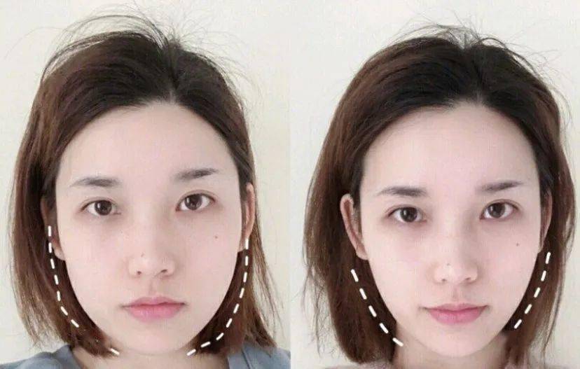 效果|这个比瘦脸针还好用的好物，既消水肿又提拉紧致，立变小V脸！