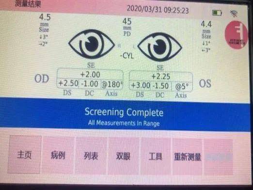 婴儿应当从六个月开始视力筛查,包括:屈光度,斜视,瞳孔大小等,建立