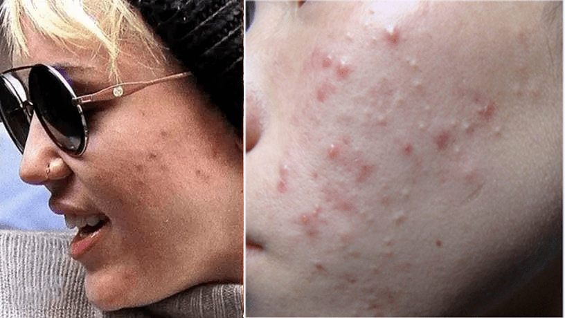 张天|张天爱比杨幂会“撩”?让小奶狗痴迷的她,到底有啥不一样?