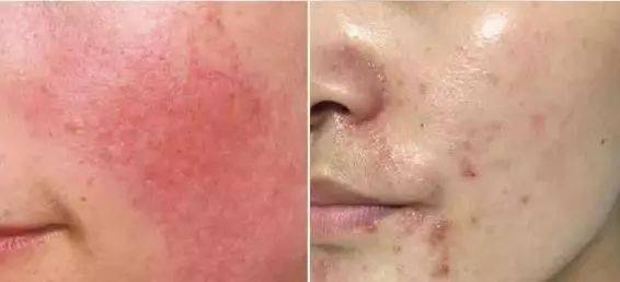 张天|张天爱比杨幂会“撩”?让小奶狗痴迷的她,到底有啥不一样?