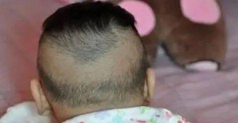 缺钙|宝宝睡觉不踏实,你以为他是缺钙了?不,可能是这些原因!