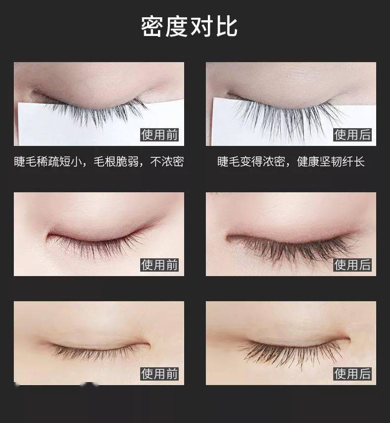 圣雪兰|快扔掉你的睫毛膏 ！这支睫毛增长液亲测有效 ！